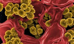 Lejyoner Hastalığı Eğitimi düzenlenecek