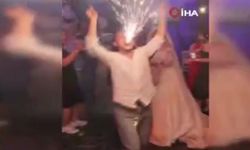 Video haber: Ağzıyla tuttuğu meşale yüzünde patladı