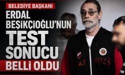 Erdal Beşikçioğlu'nun test sonucu belli oldu?