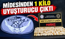 Midesinden 1 kilo uyuşturucu çıktı
