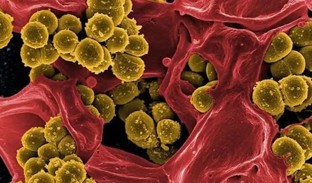 Lejyoner Hastalığı Eğitimi düzenlenecek