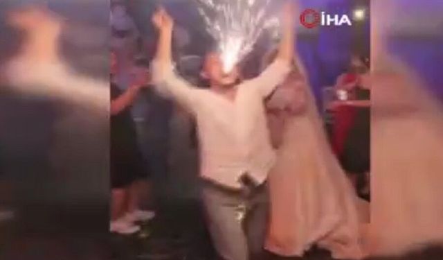 Video haber: Ağzıyla tuttuğu meşale yüzünde patladı