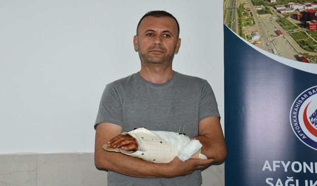 Afyon’da mucize operasyon! Kopma noktasına gelen bilek 12 saatte kurtarıldı