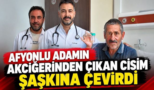 Afyonlu adamın akciğerinden çıkan cisim şaşkına çevirdi