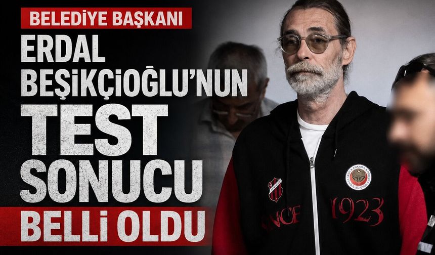 Erdal Beşikçioğlu'nun test sonucu belli oldu?