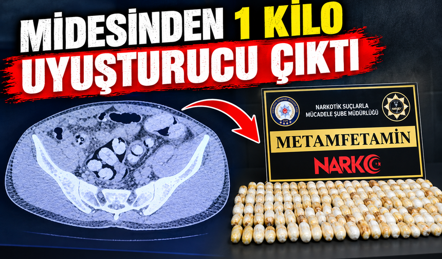 Midesinden 1 kilo uyuşturucu çıktı