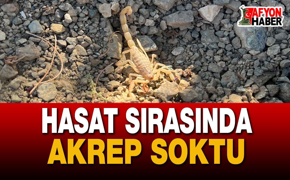 Akrep Sokması Nedeniyle Hastanelik Oldu