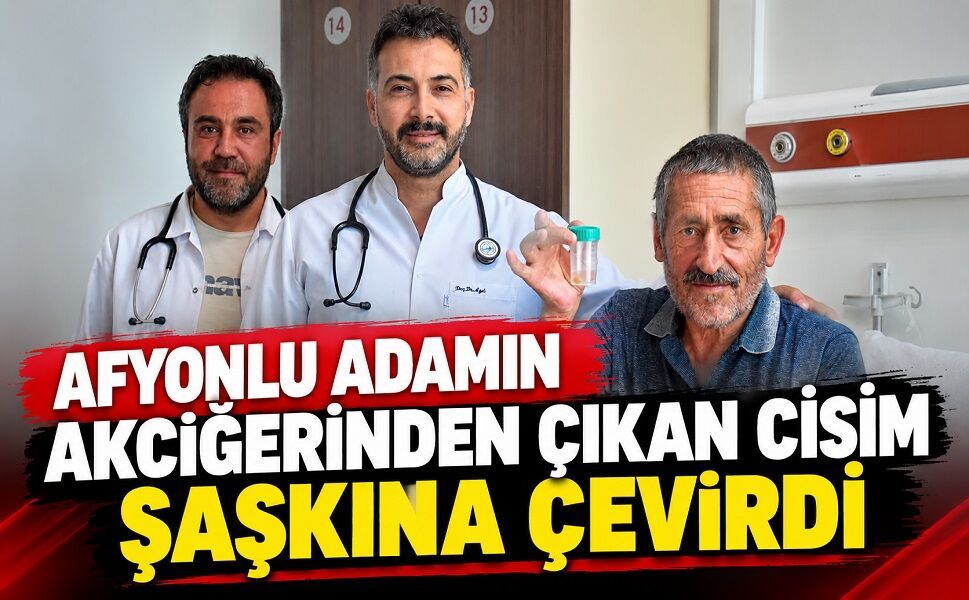 Afyonlu adamın akciğerinden çıkan cisim şaşkına çevirdi